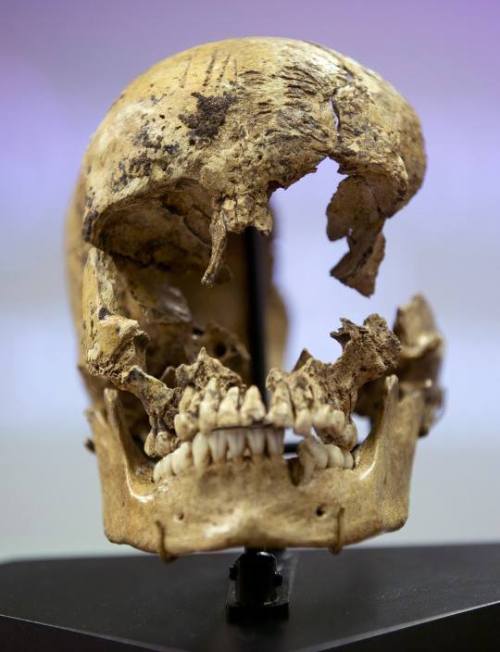 sixpenceee:
“ Skull of a 14 year-old girl believed to be a victim of cannibalism at the Jamestown colony in the winter of 1609. Butchery marks can be seen on forehead
(Source)
”