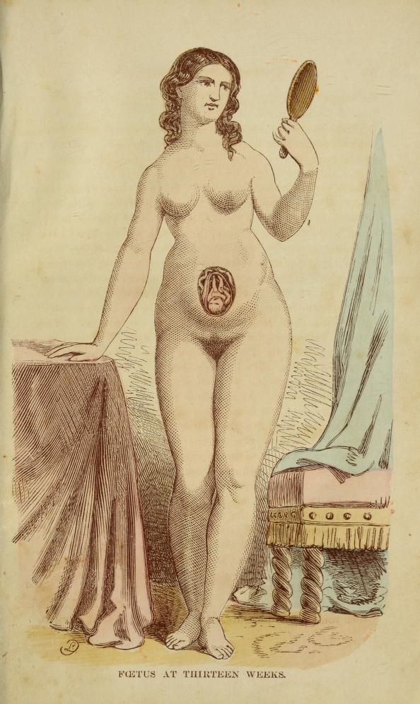 nemfrog:
“ “Foetus at thirteen weeks.” The book of nature : containing information for young people who think of getting married. 1861.
”